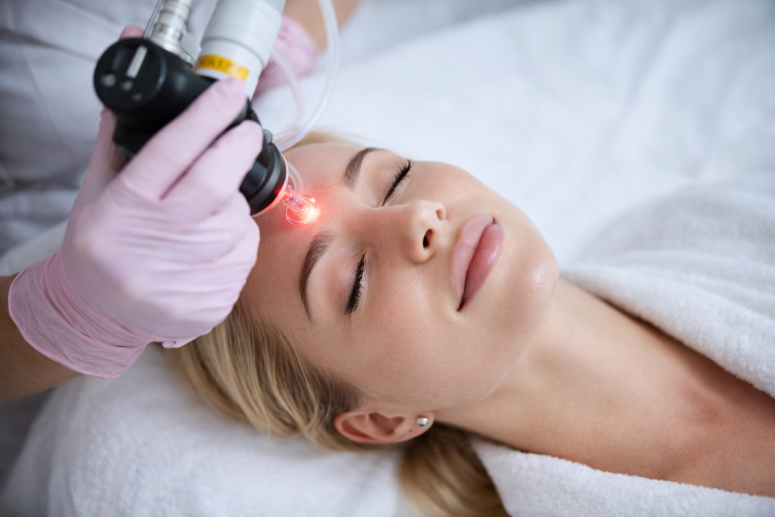 Laser skin resurfacing in Portland and Vancouver at Cosmetiq Medicine
