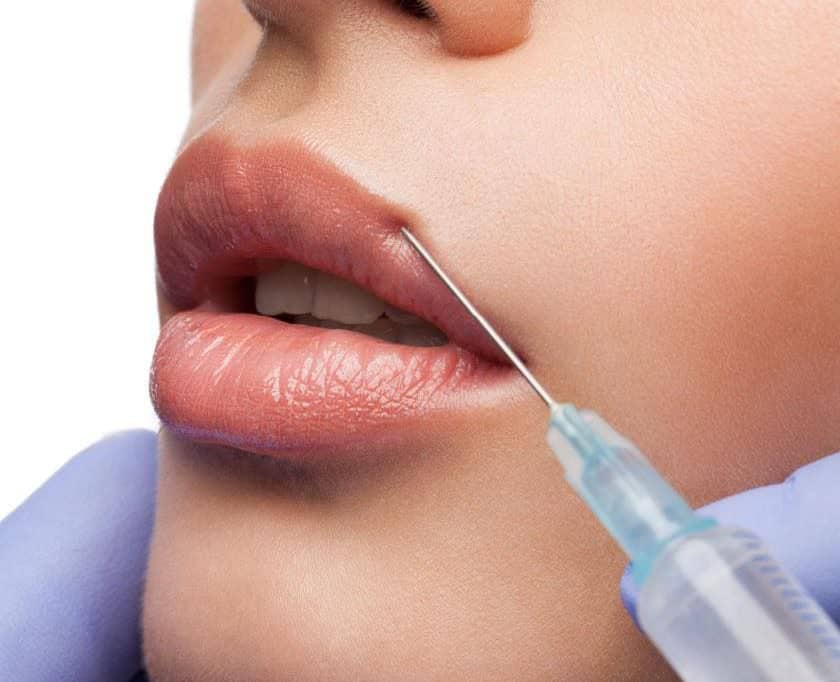 Lip filler discounts in Portland OR and Vancouver WA at Cosmetiq Medicine
