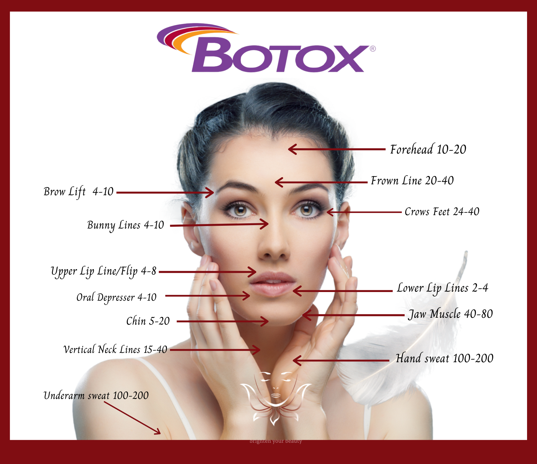 Chart Showing Prominent Injection Sites for Botox and Dysport, such as the Forehead, Frown Lines, Eyebrows, Crows Feet, Bunny Lines, Upper and Lower Lips, Chin, and Neck.