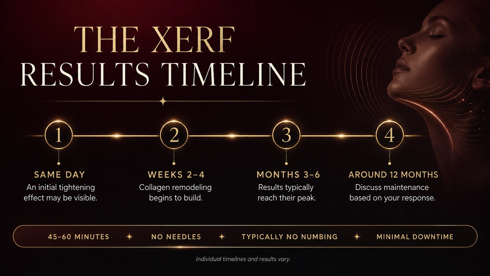 XERF treatment results timeline showing same-day tightening through peak collagen remodeling at three to six months, at Cosmetiq Medicine in Vancouver WA serving Portland Oregon