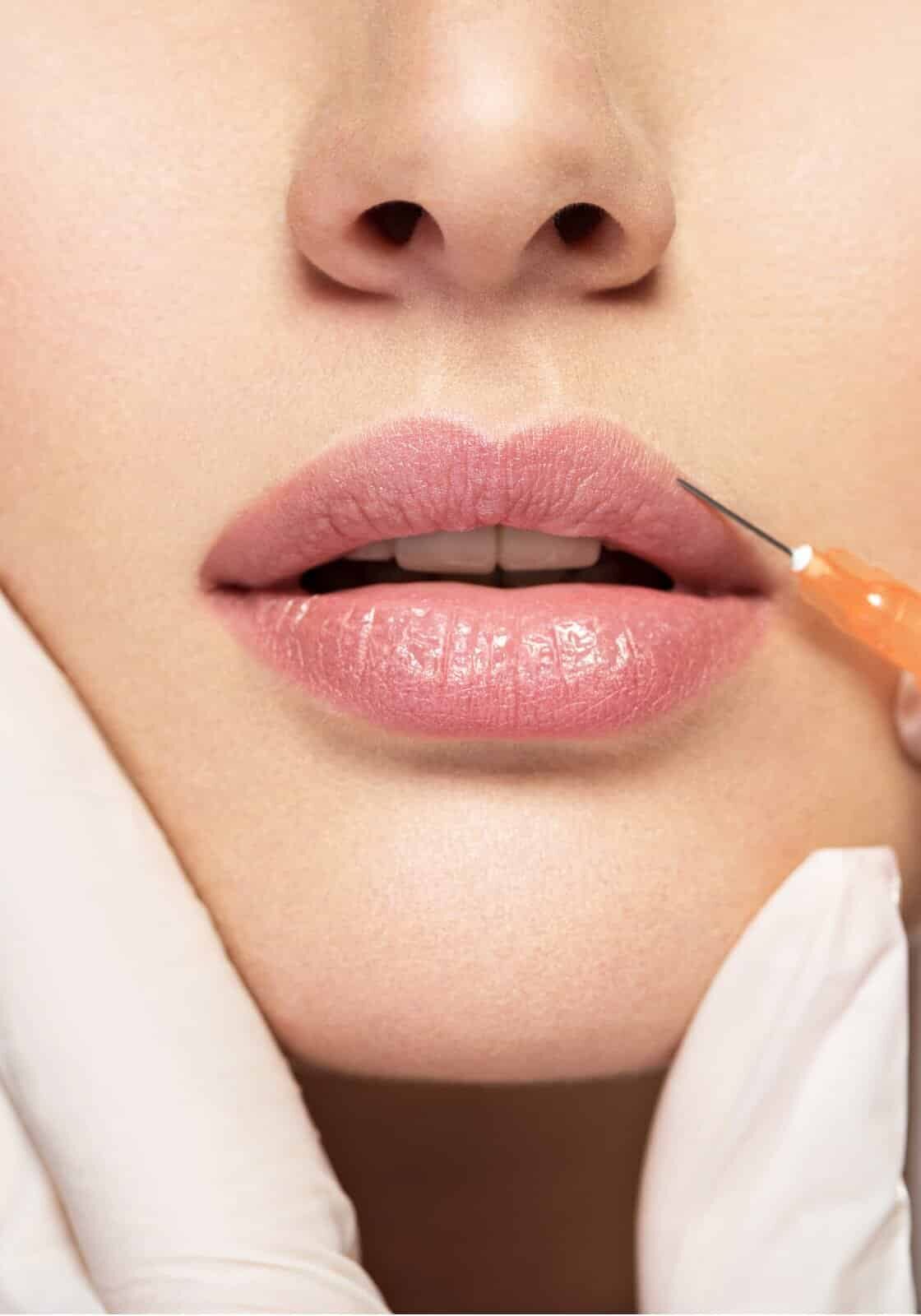 Lip filler Portland Oregon from Cosmetiq Medicine