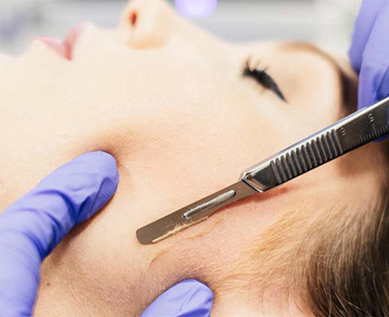 Picture shown of Dermaplaning procedure being performed on patient.