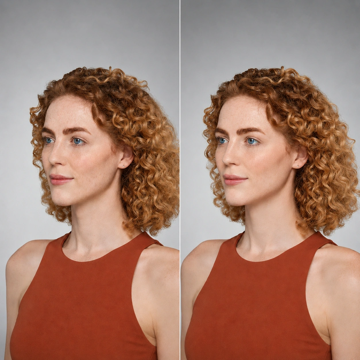 Facial balancing dermal filler before and after results at Cosmetiq Medicine in Vancouver, WA