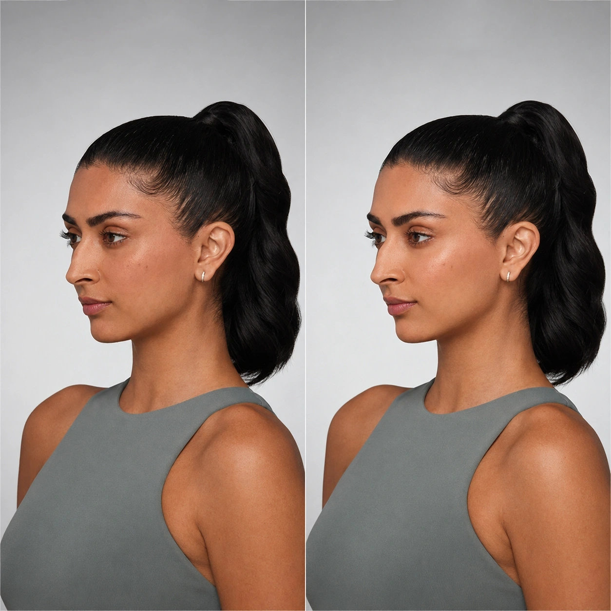 Facial fillers before and after three-quarter view results at Cosmetiq Medicine Portland med spa