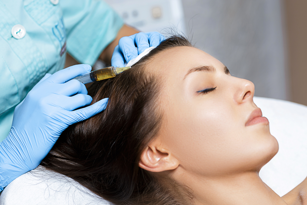 A PRP Hair Restoration being performed on a patient, portraying the injection being done on the scalp.