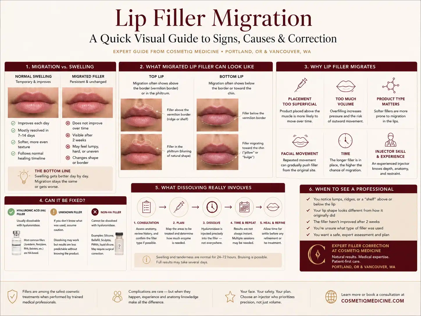 Infographic showing the main causes of lip filler migration and how it is corrected, from Cosmetiq Medicine in Portland OR and Vancouver WA