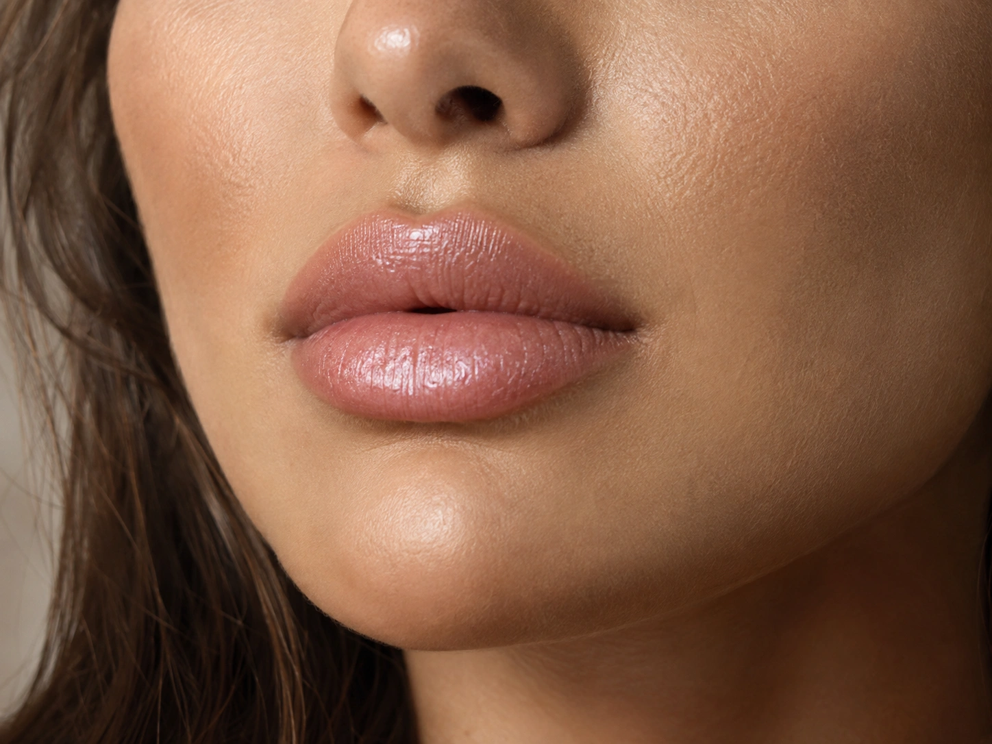 Natural lip filler result at Cosmetiq Medicine in Portland
