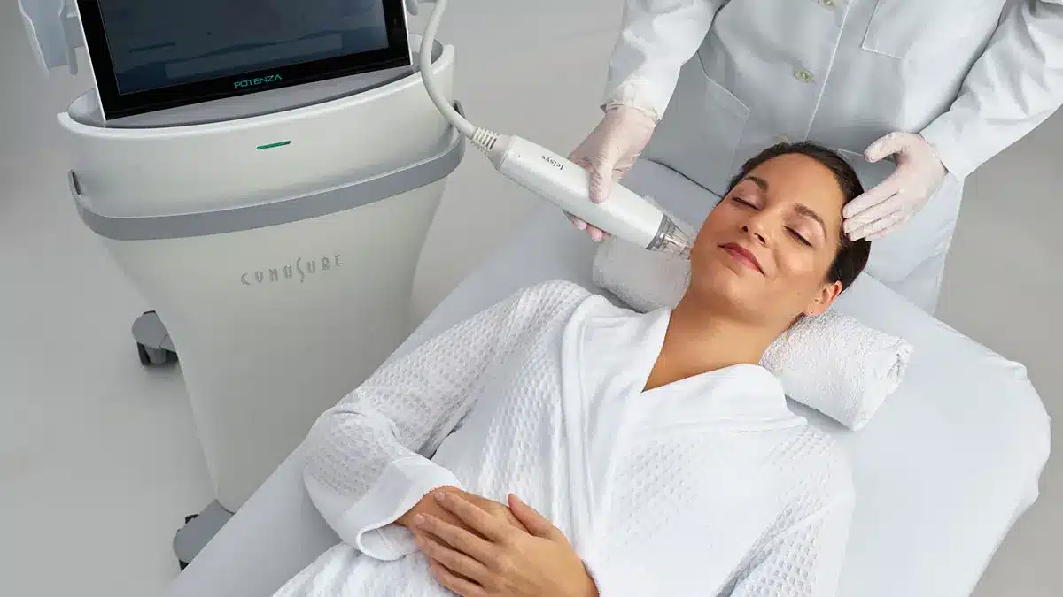 Patient relaxing on the treatment bed before an RF microneedling session